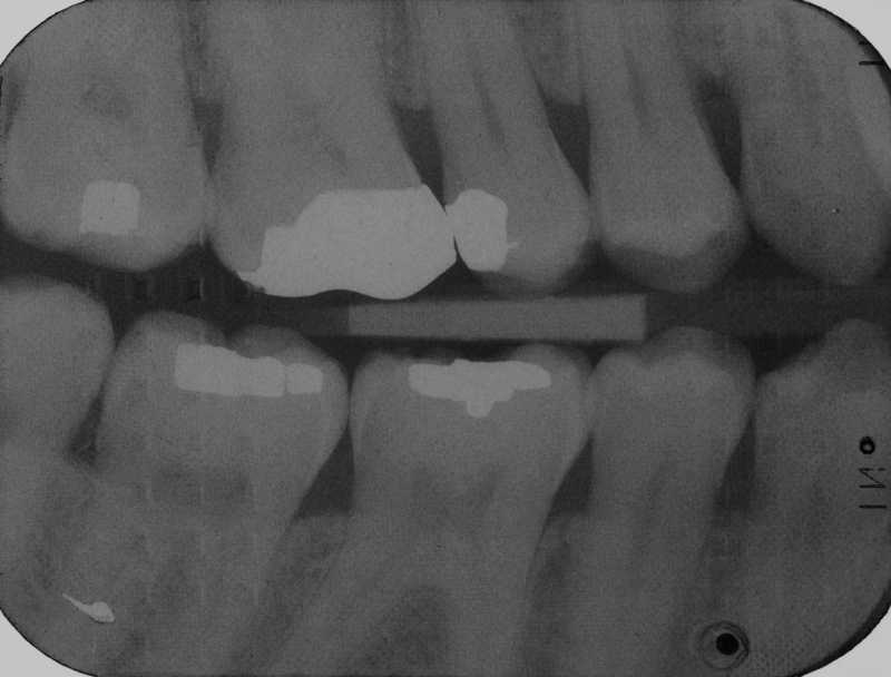 Dental Radiography Film Faults. Quiz 1 Enhanced Dental CPD Online