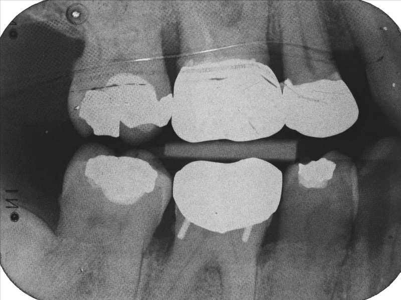 Dental Radiography Film Faults. Quiz 1 Enhanced Dental CPD Online
