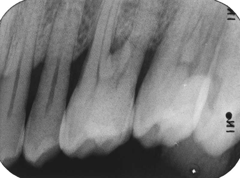 Dental Radiography Film Faults. Quiz 1 Enhanced Dental CPD Online