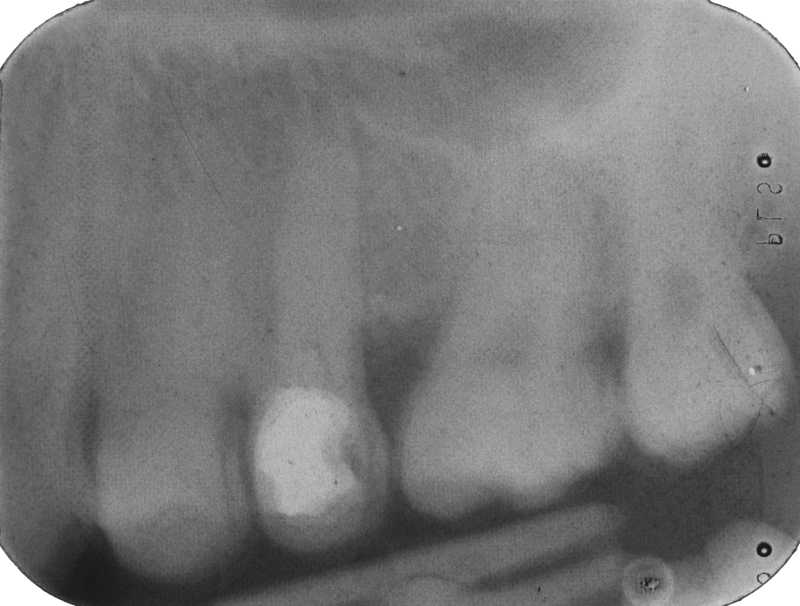 Dental Radiography Film Faults. Quiz 1 Enhanced Dental CPD Online