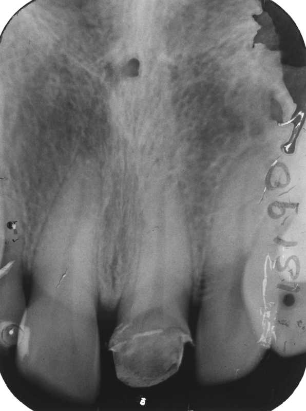 Dental Radiography Film Faults. Quiz 1 Enhanced Dental CPD Online