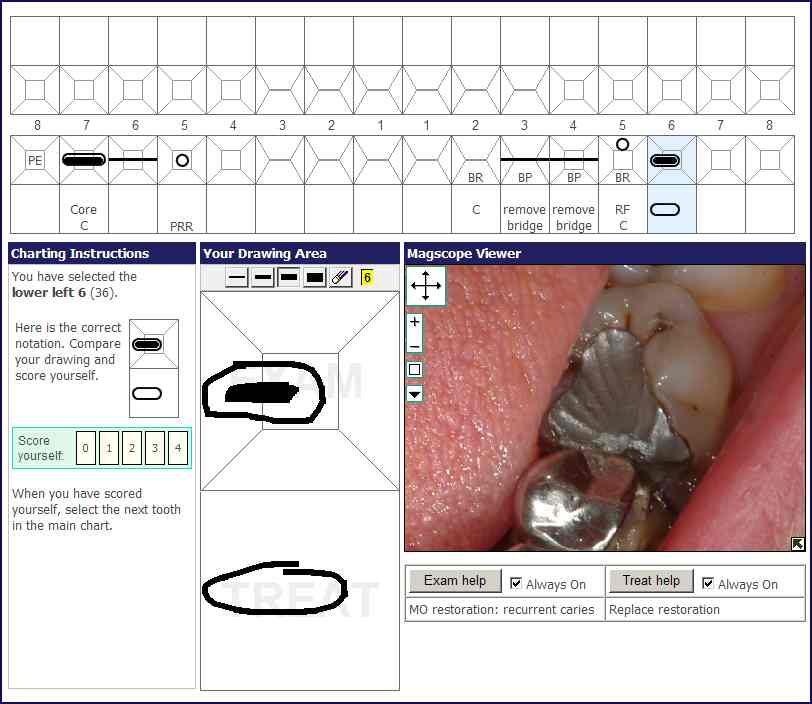 Practice Dental Charting Online Free