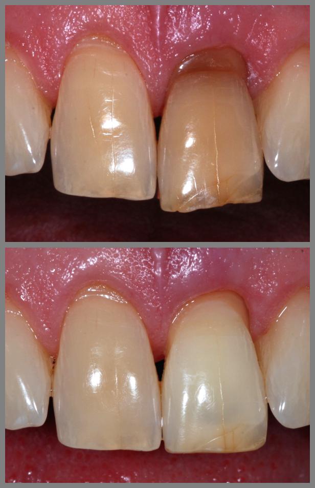 magnify Before and After