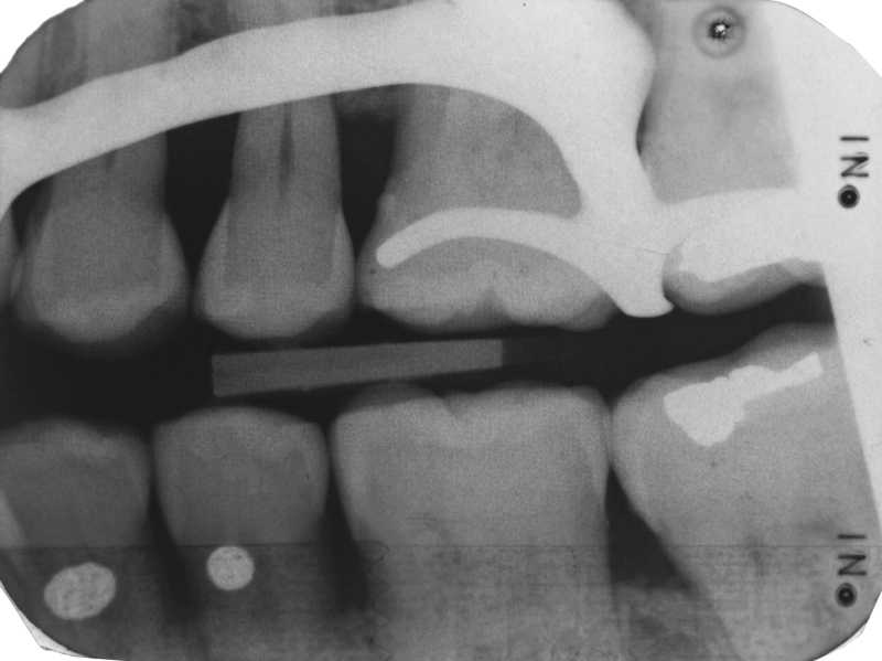 Dental Radiography Film Faults. Quiz 1