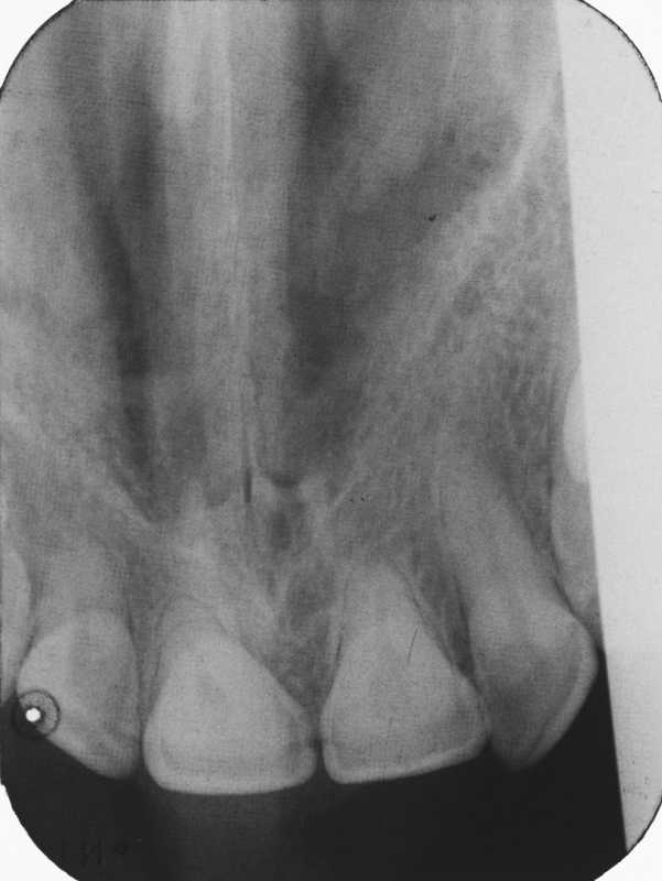 Dental Radiography Film Faults. Quiz 1